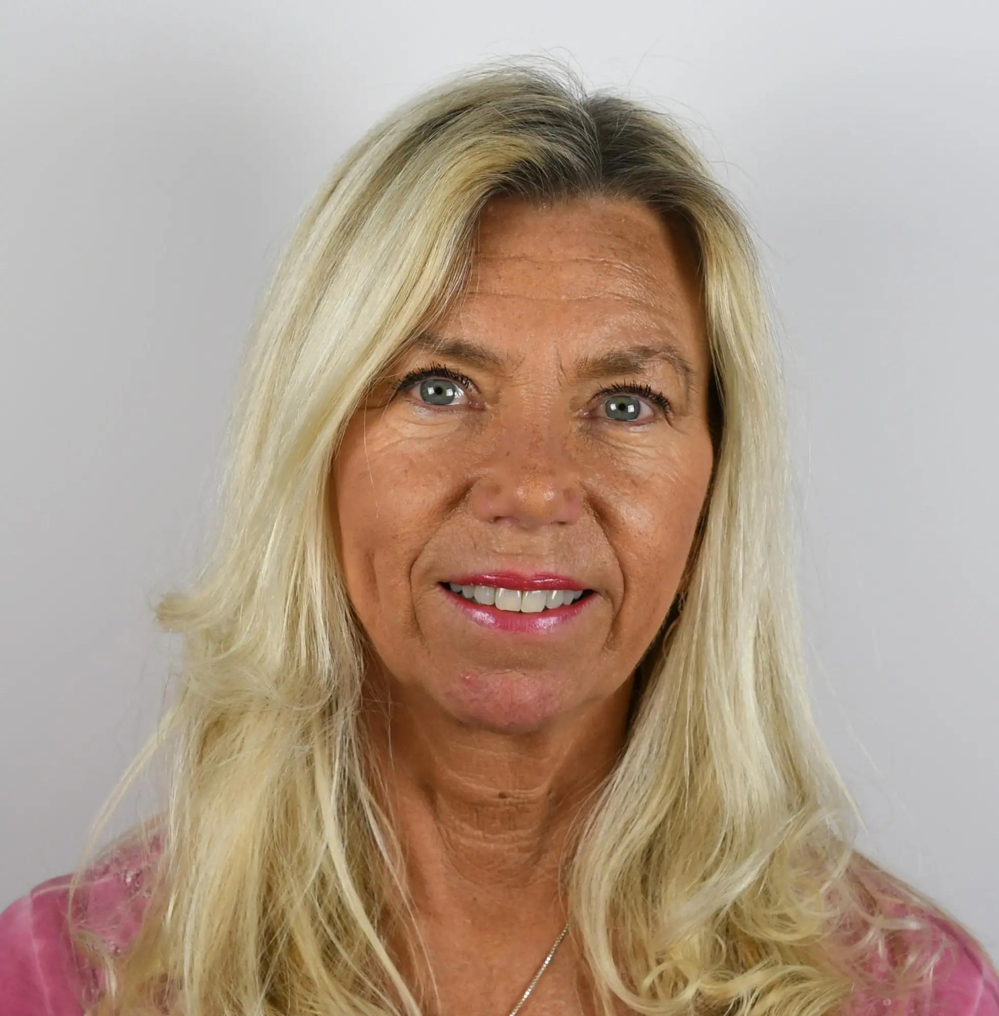 Kontaktbild